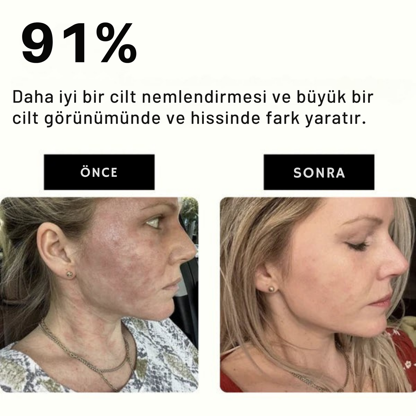 Akcakese™ Filtreli Duş Başlığı